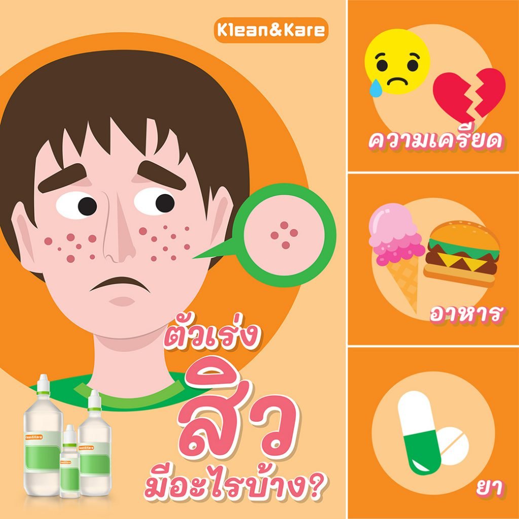 ตัวเร่งที่ทำให้เกิดสิว – Anb Lab